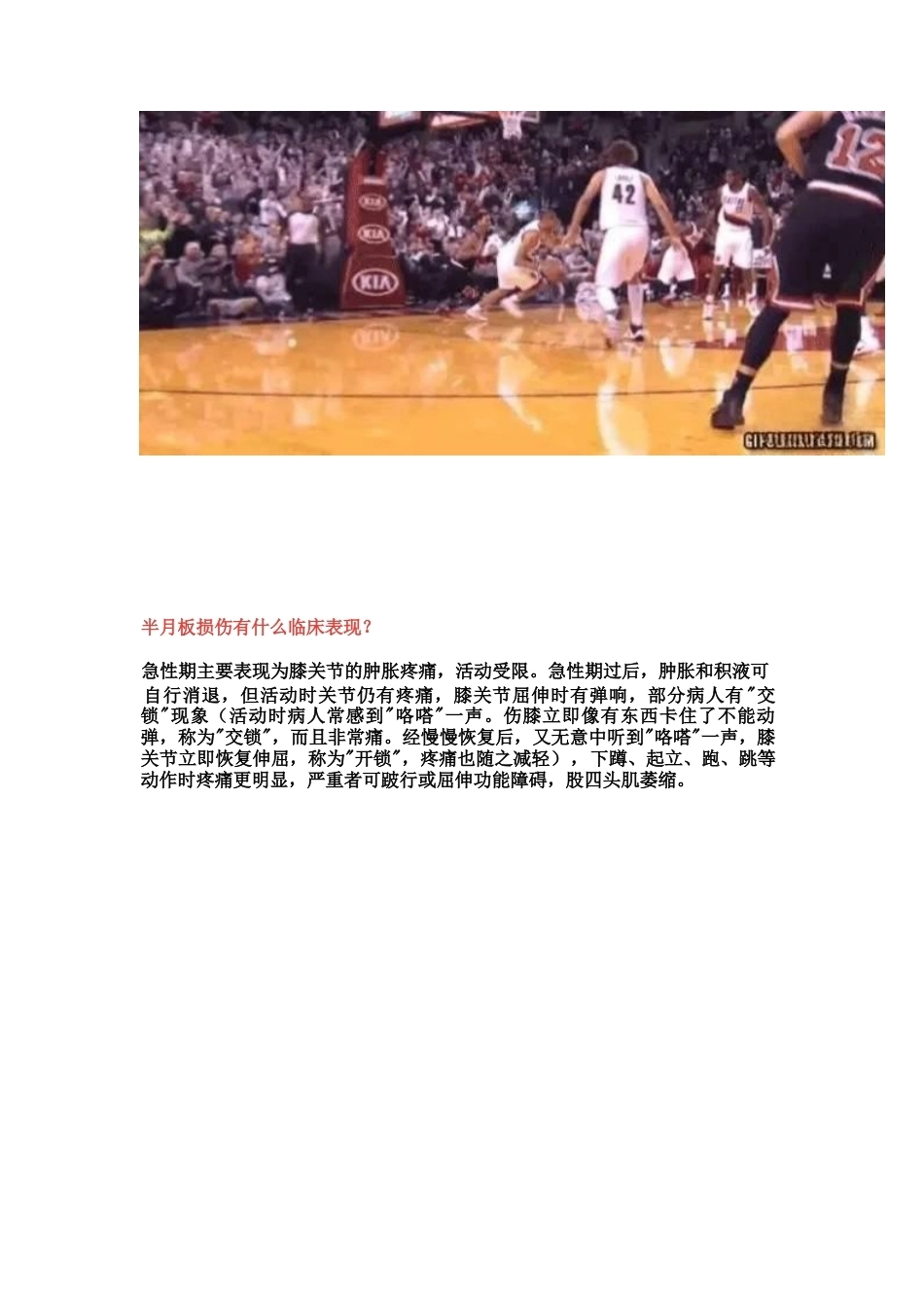 半月板损伤的治 疗技巧_第3页