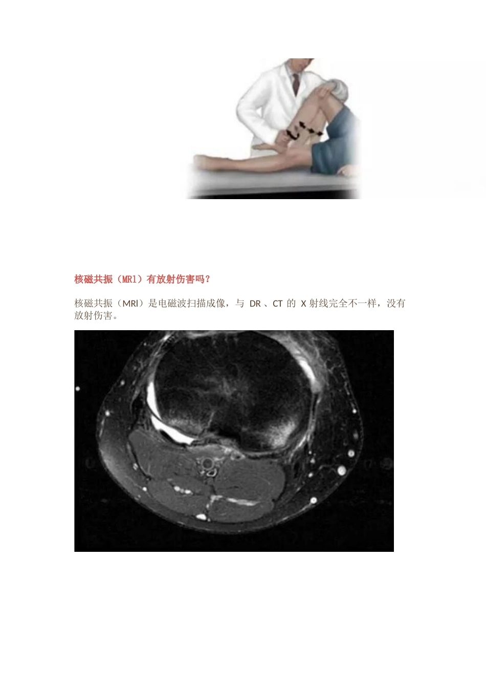 半月板损伤的治 疗技巧_第5页