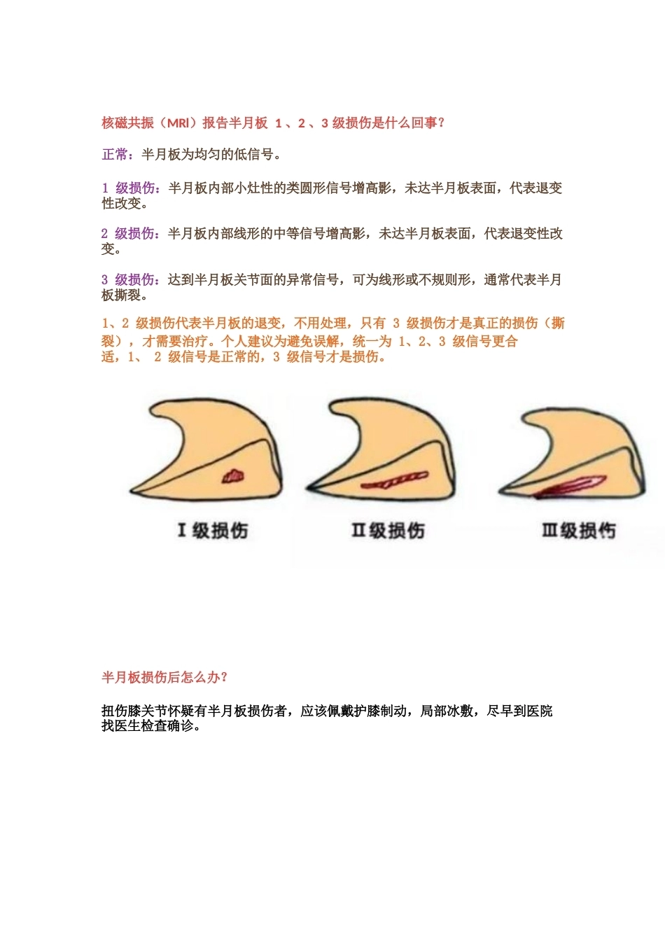 半月板损伤的治 疗技巧_第6页