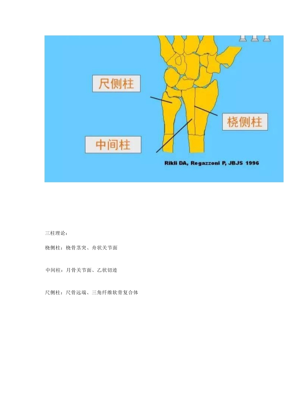 桡骨远端骨折 的治疗策略_第5页