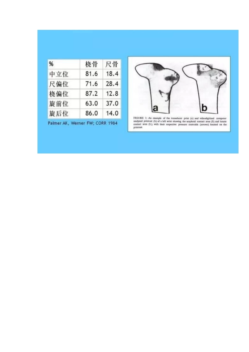桡骨远端骨折 的治疗策略_第6页