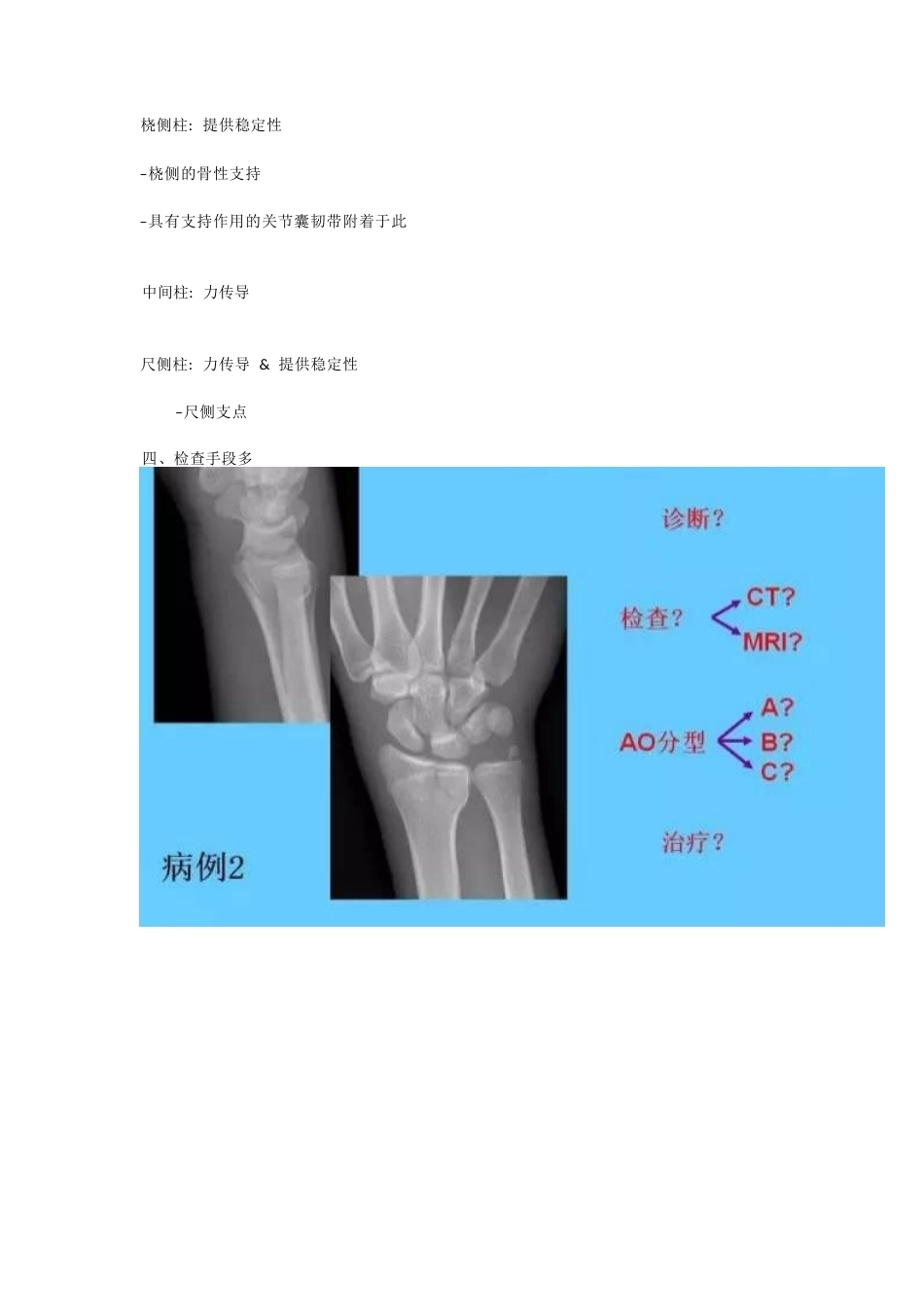 桡骨远端骨折 的治疗策略_第9页