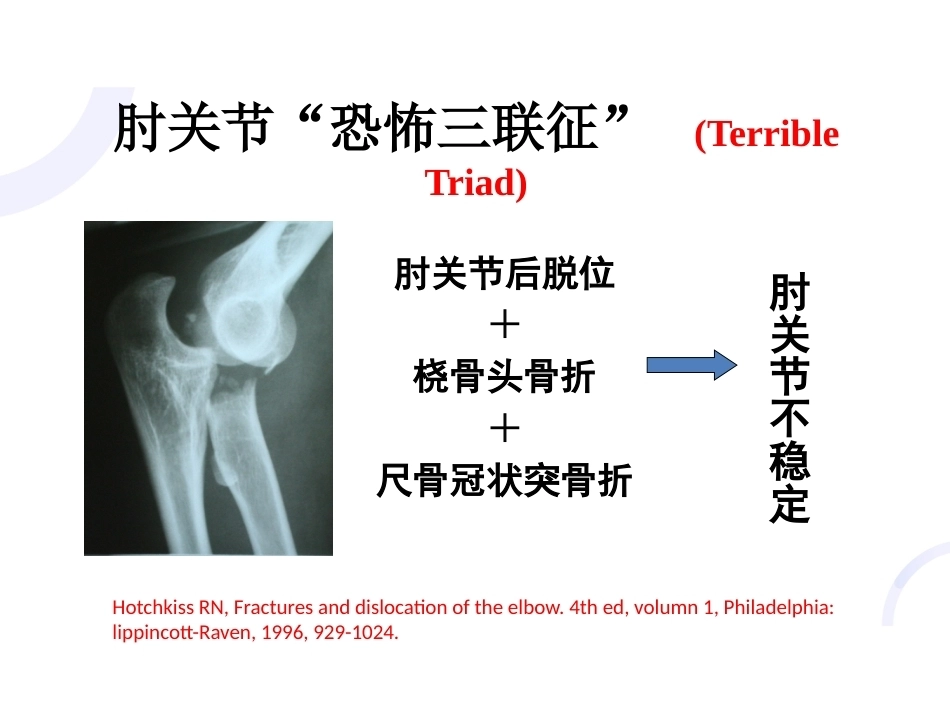 肘关节“恐怖三 联征“_第3页