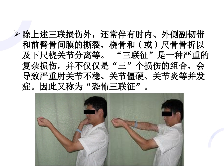 肘关节“恐怖三 联征“_第4页