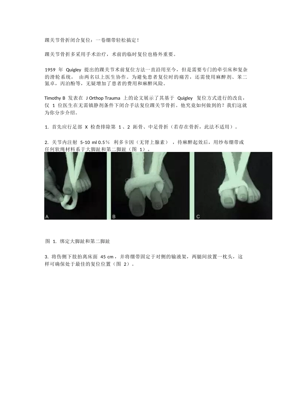 踝关节骨折闭合 复位技巧_第1页