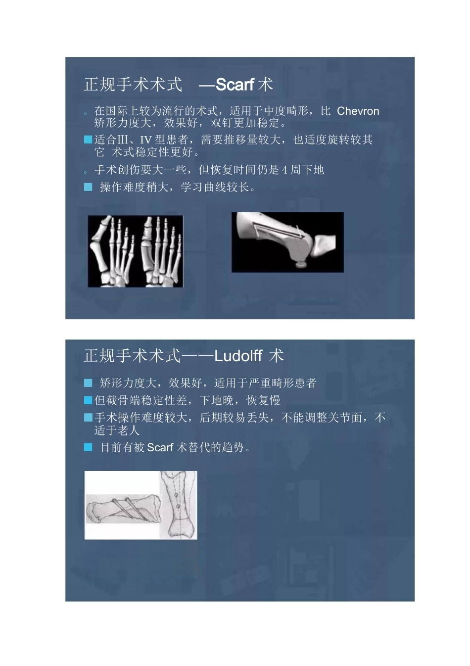 拇外翻的分型及术式的选择_第7页