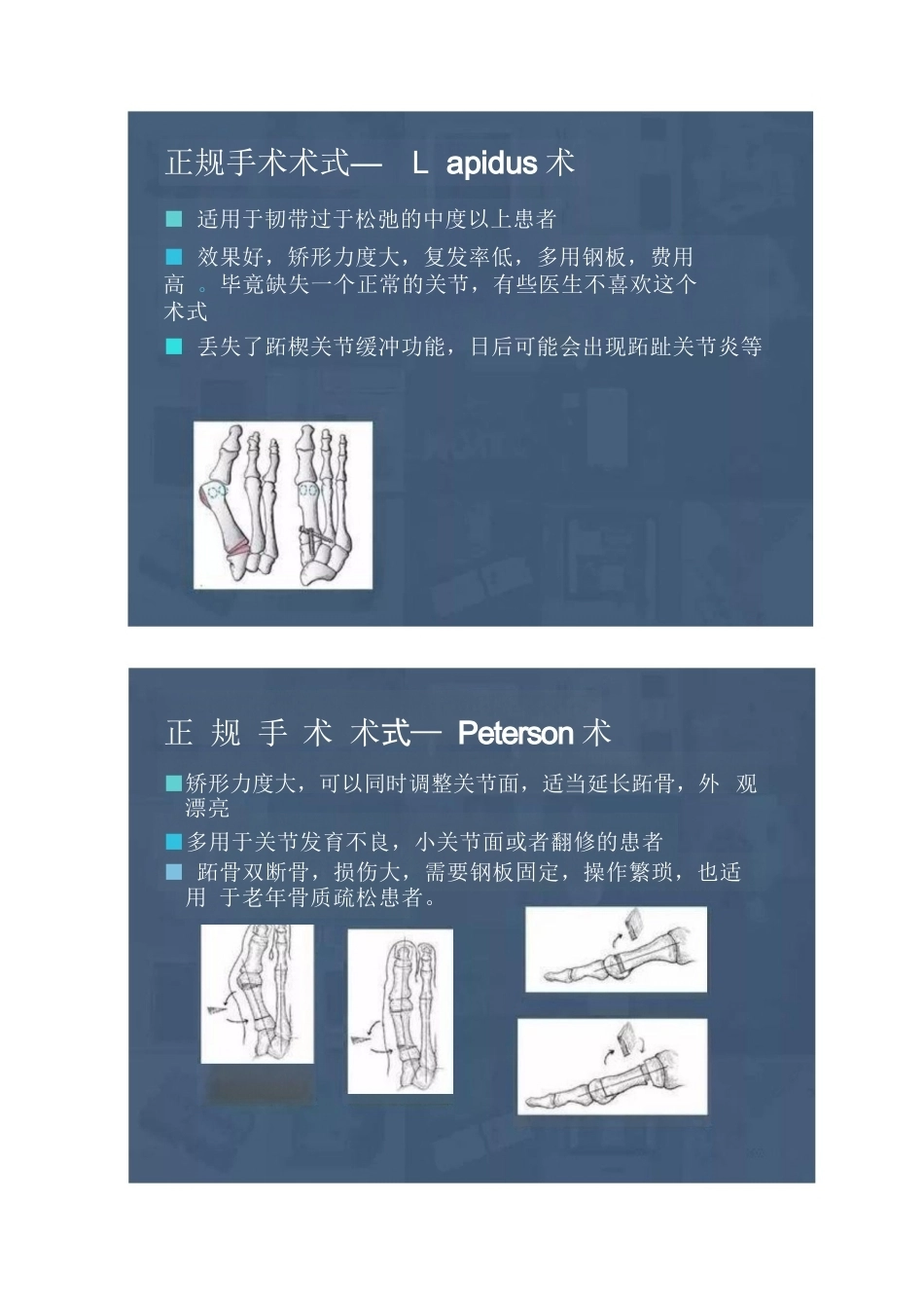 拇外翻的分型及术式的选择_第8页