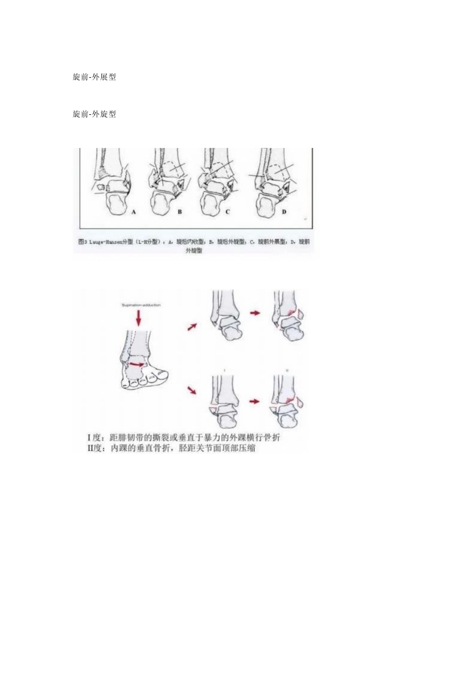 下肢骨折分型大全_第11页
