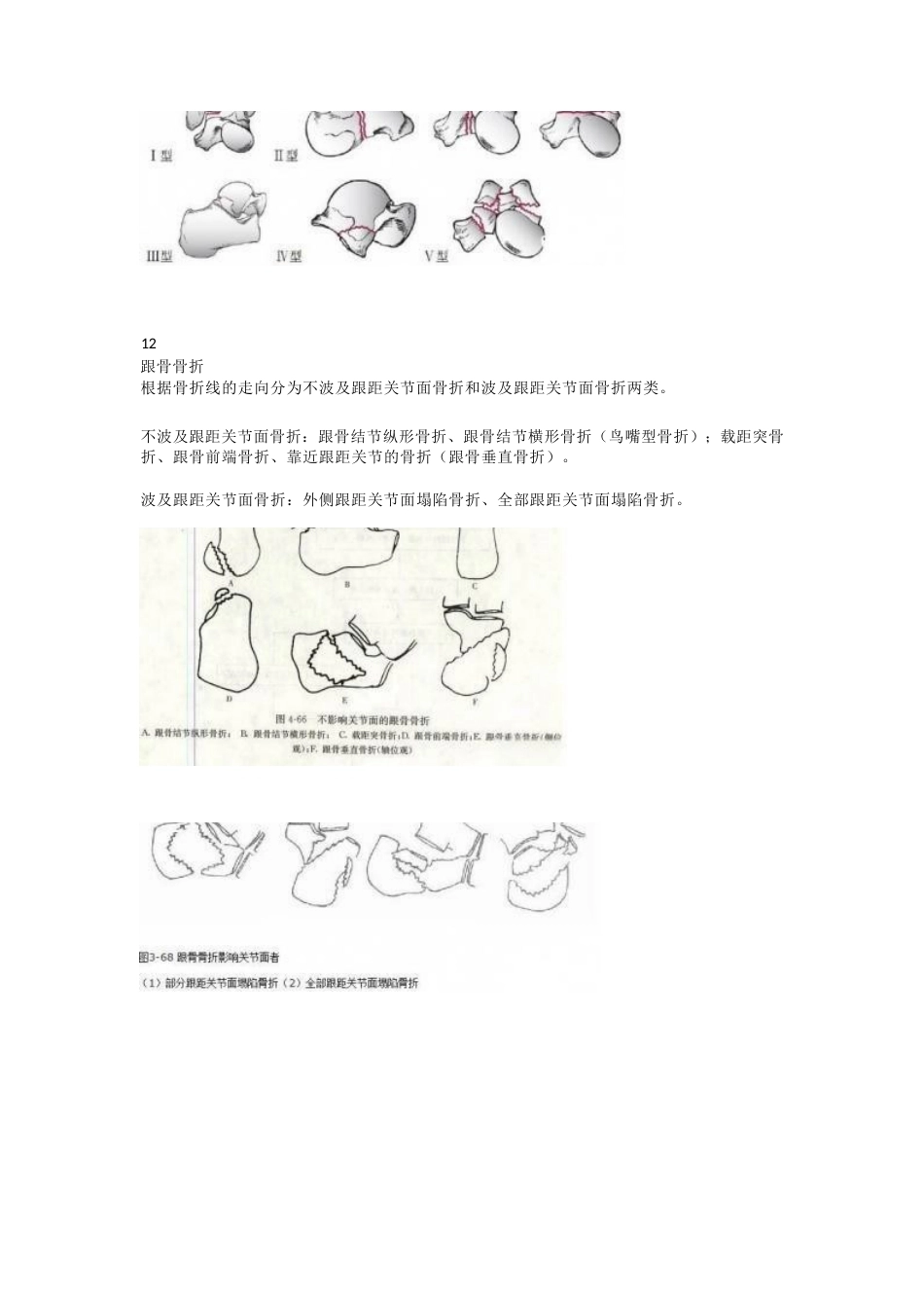 下肢骨折分型大全_第14页