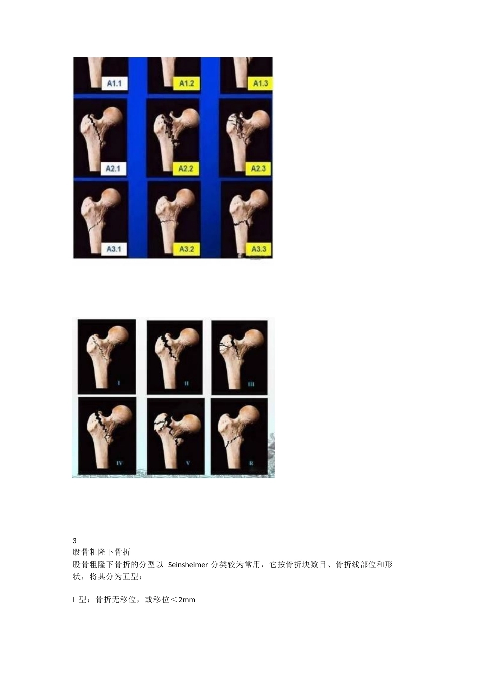 下肢骨折分型大全_第4页