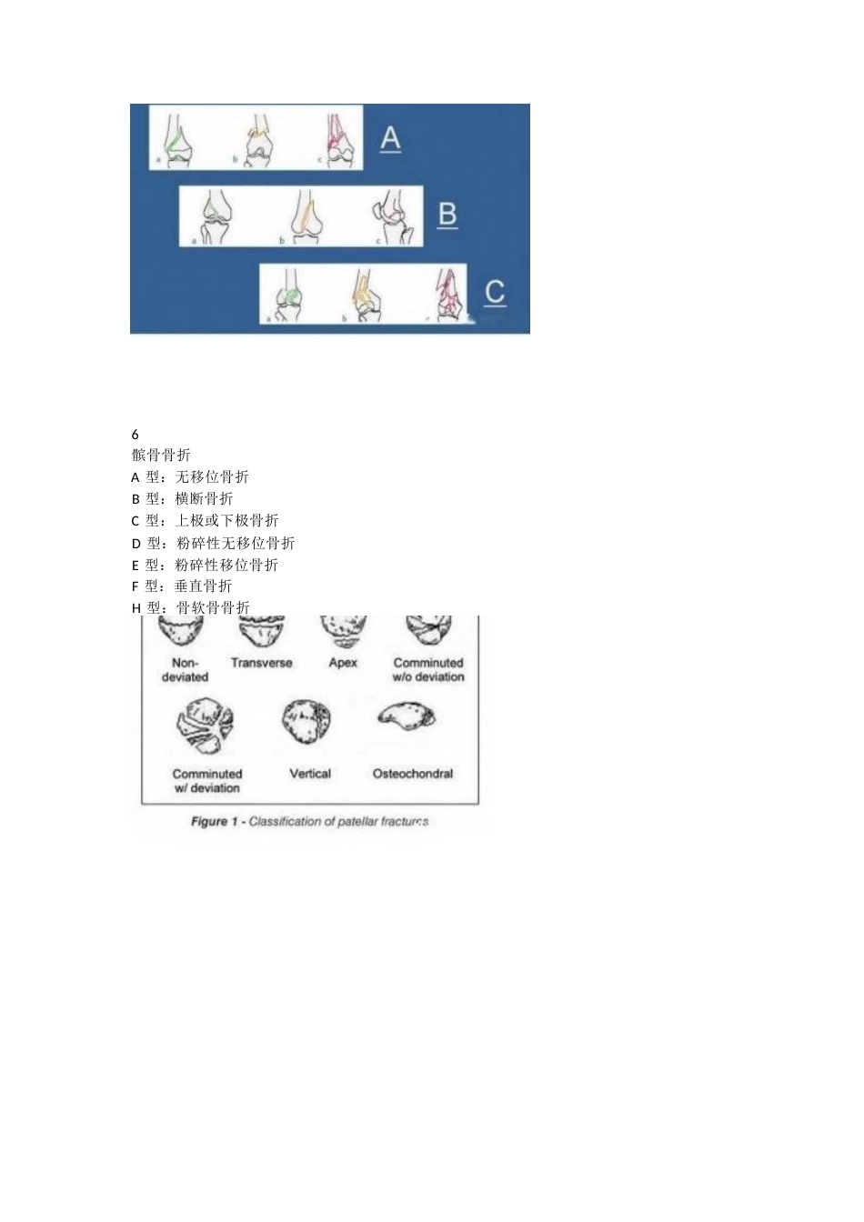 下肢骨折分型大全_第7页