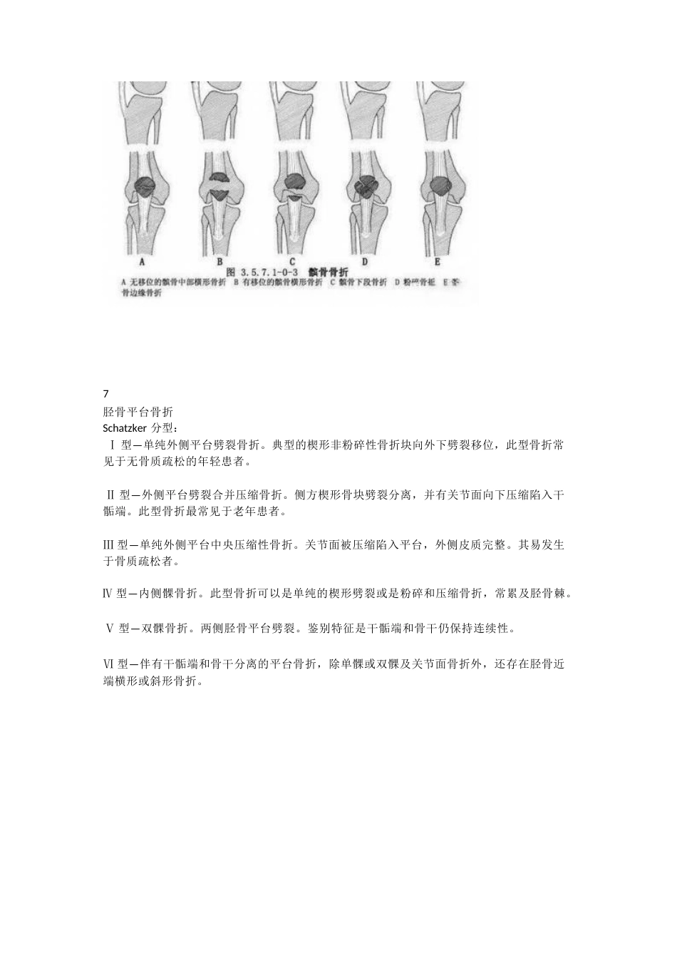 下肢骨折分型大全_第8页
