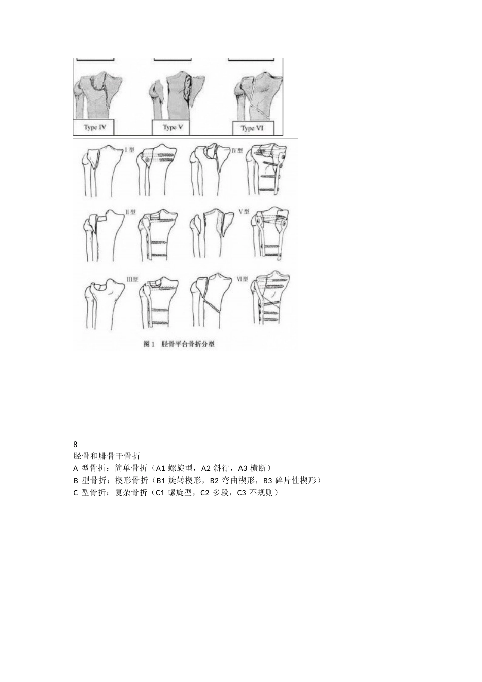 下肢骨折分型大全_第9页