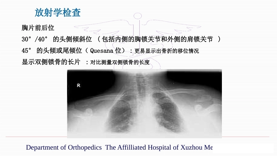 锁骨远端骨折伴肩锁 关节脱位的治疗_第13页