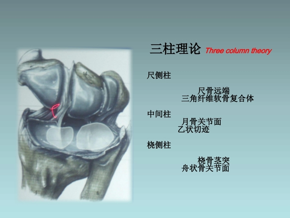 桡骨远端骨折的治疗_第10页