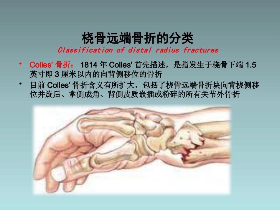 桡骨远端骨折的治疗_第11页