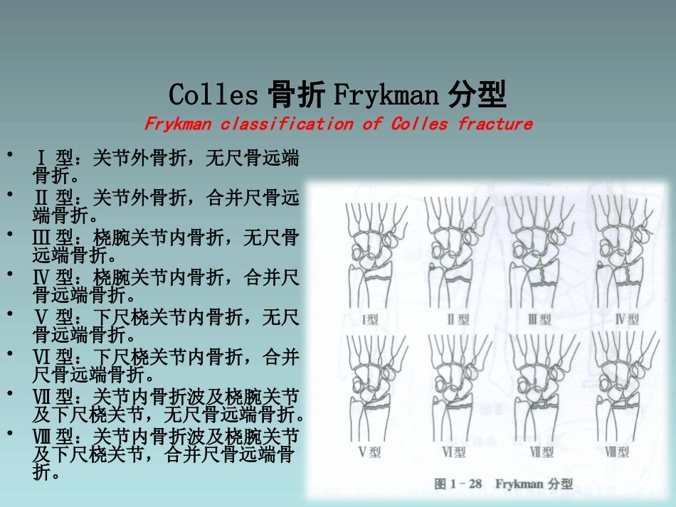 桡骨远端骨折的治疗_第12页