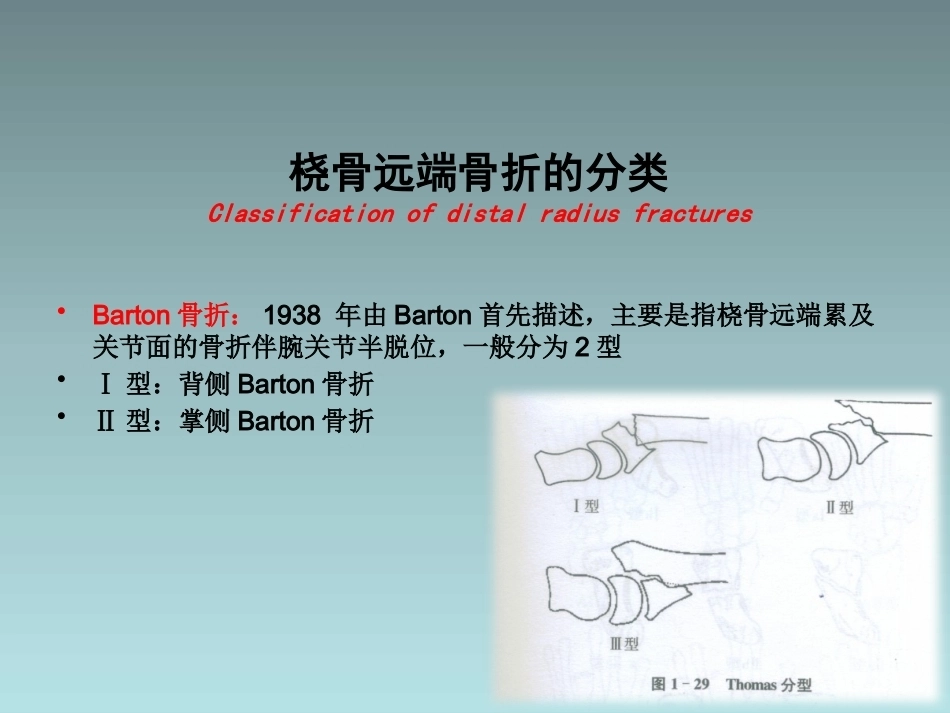 桡骨远端骨折的治疗_第14页