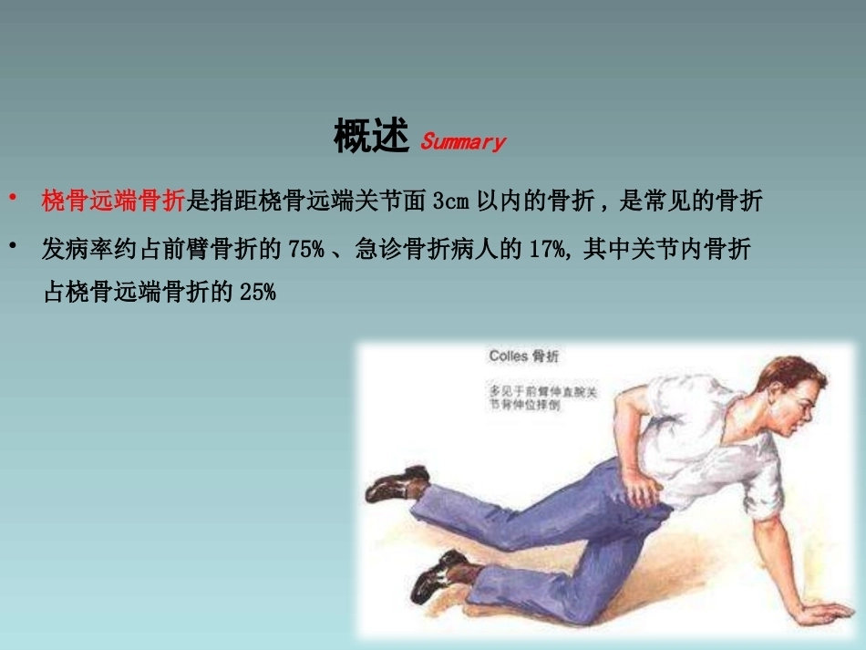 桡骨远端骨折的治疗_第2页