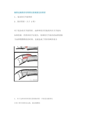 桡骨远端的复 位技巧