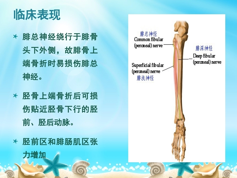 胫腓骨骨折分型_第13页
