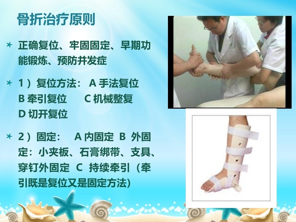 胫腓骨骨折分型_第14页