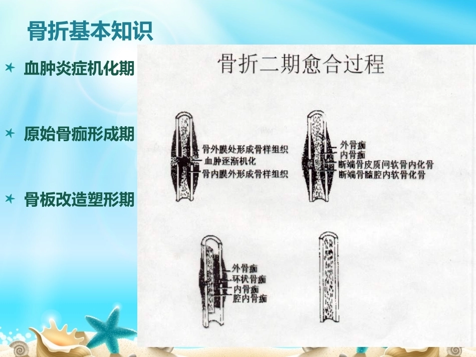 胫腓骨骨折分型_第5页