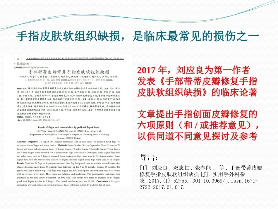 手指创面皮瓣修复的六项原则_第2页