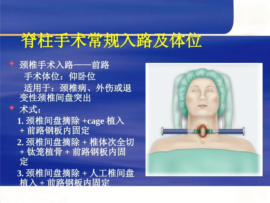 脊柱手术 体位摆放要点_第13页