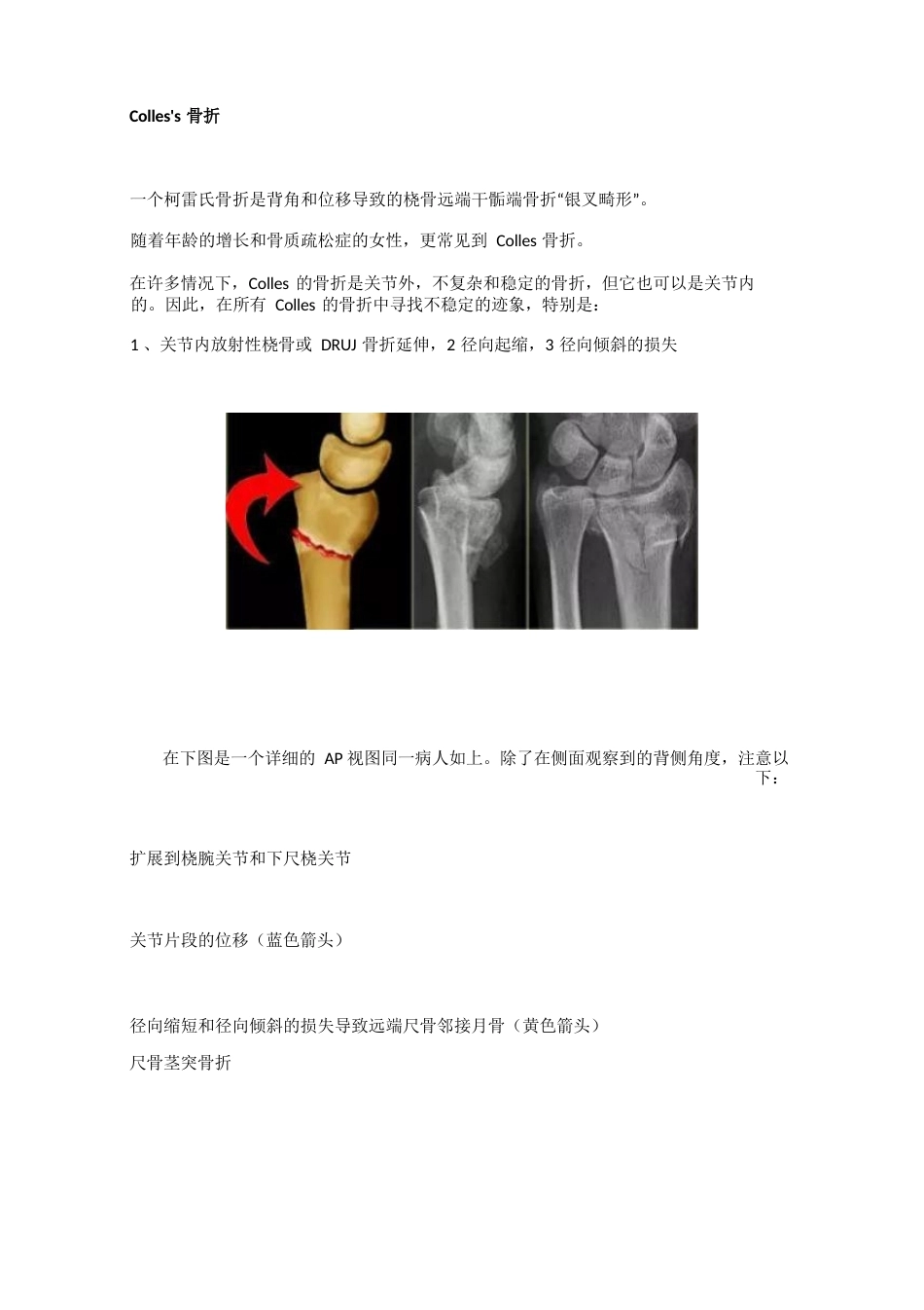 腕关节骨折的影像、分型_第11页