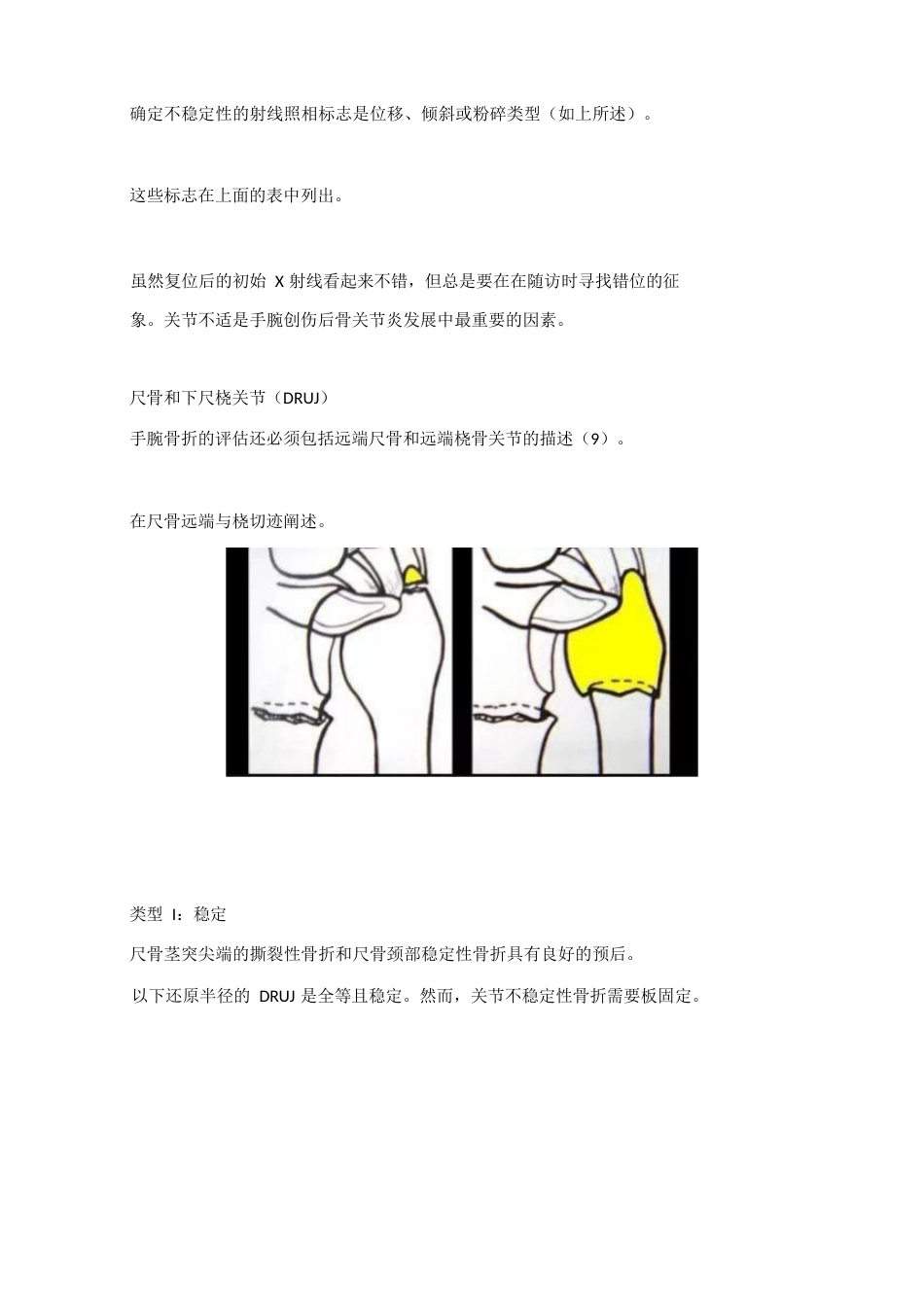 腕关节骨折的影像、分型_第9页