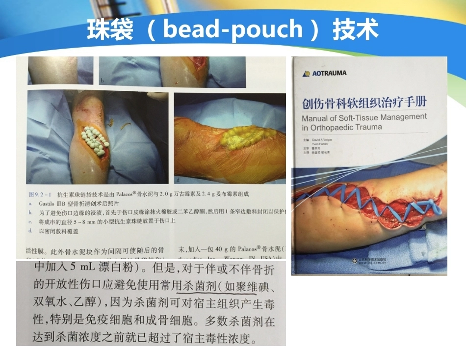 上肢外伤手术技 术与技巧_第5页