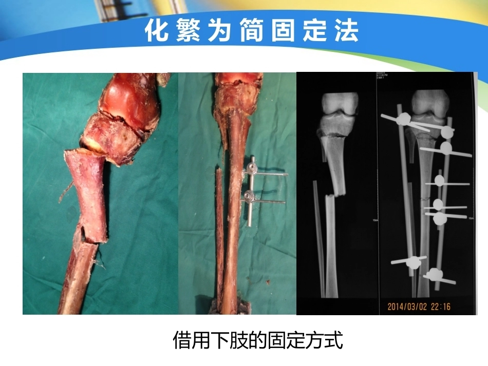 上肢外伤手术技 术与技巧_第6页