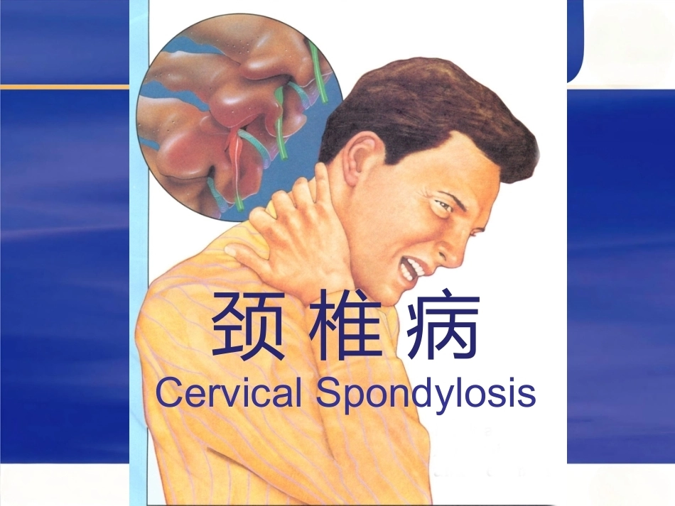颈椎病的诊断与治疗原则_第5页