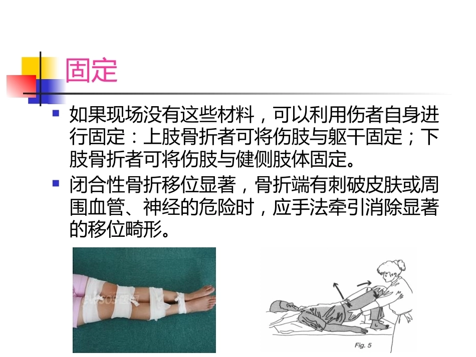 常见 外伤的急救_第14页