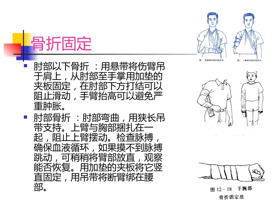 常见 外伤的急救_第15页