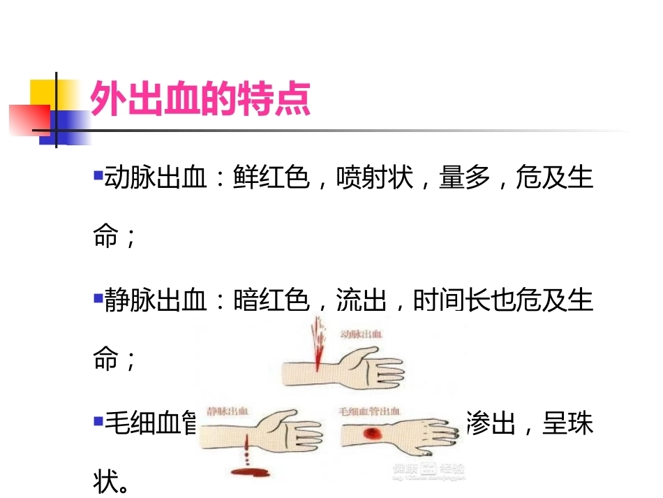 常见 外伤的急救_第6页