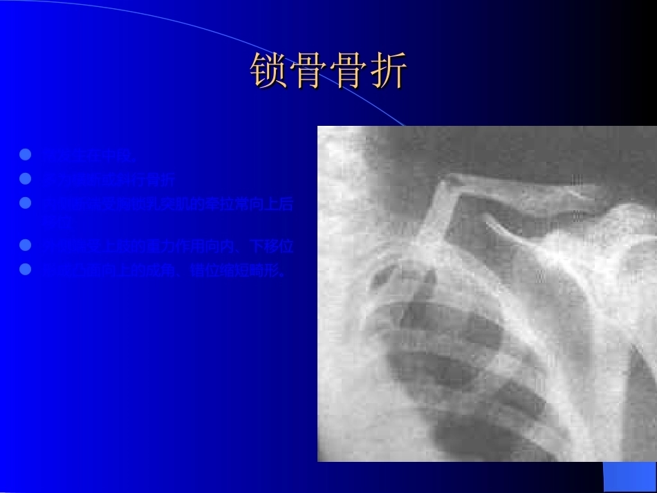 骨科常见疾病的X线表现_第3页
