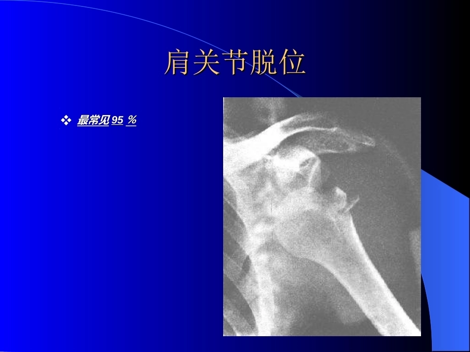 骨科常见疾病的X线表现_第6页