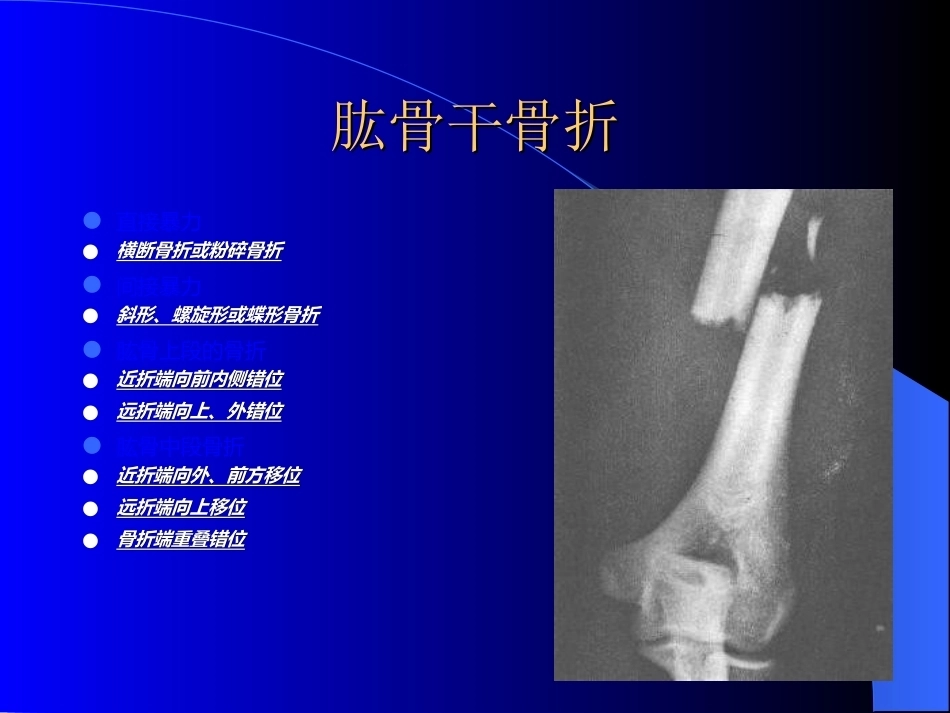 骨科常见疾病的X线表现_第8页