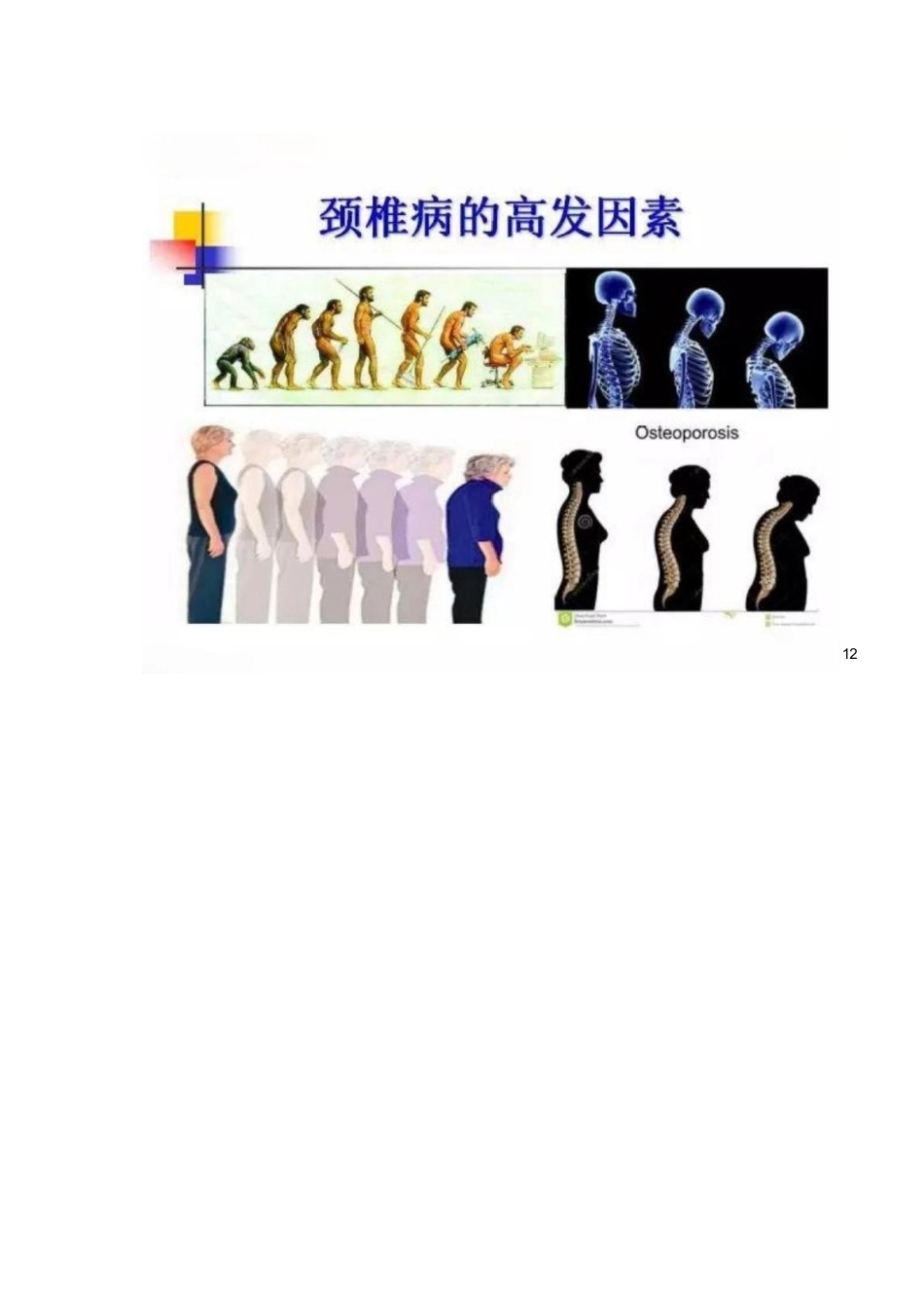 颈椎病的分型与治疗要点_第10页