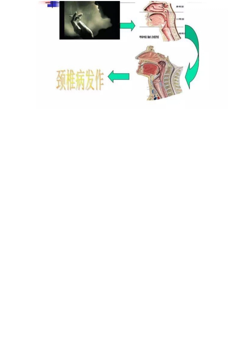 颈椎病的分型与治疗要点_第13页