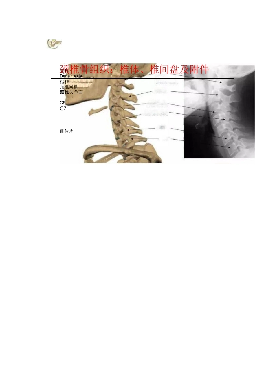颈椎病的分型与治疗要点_第4页