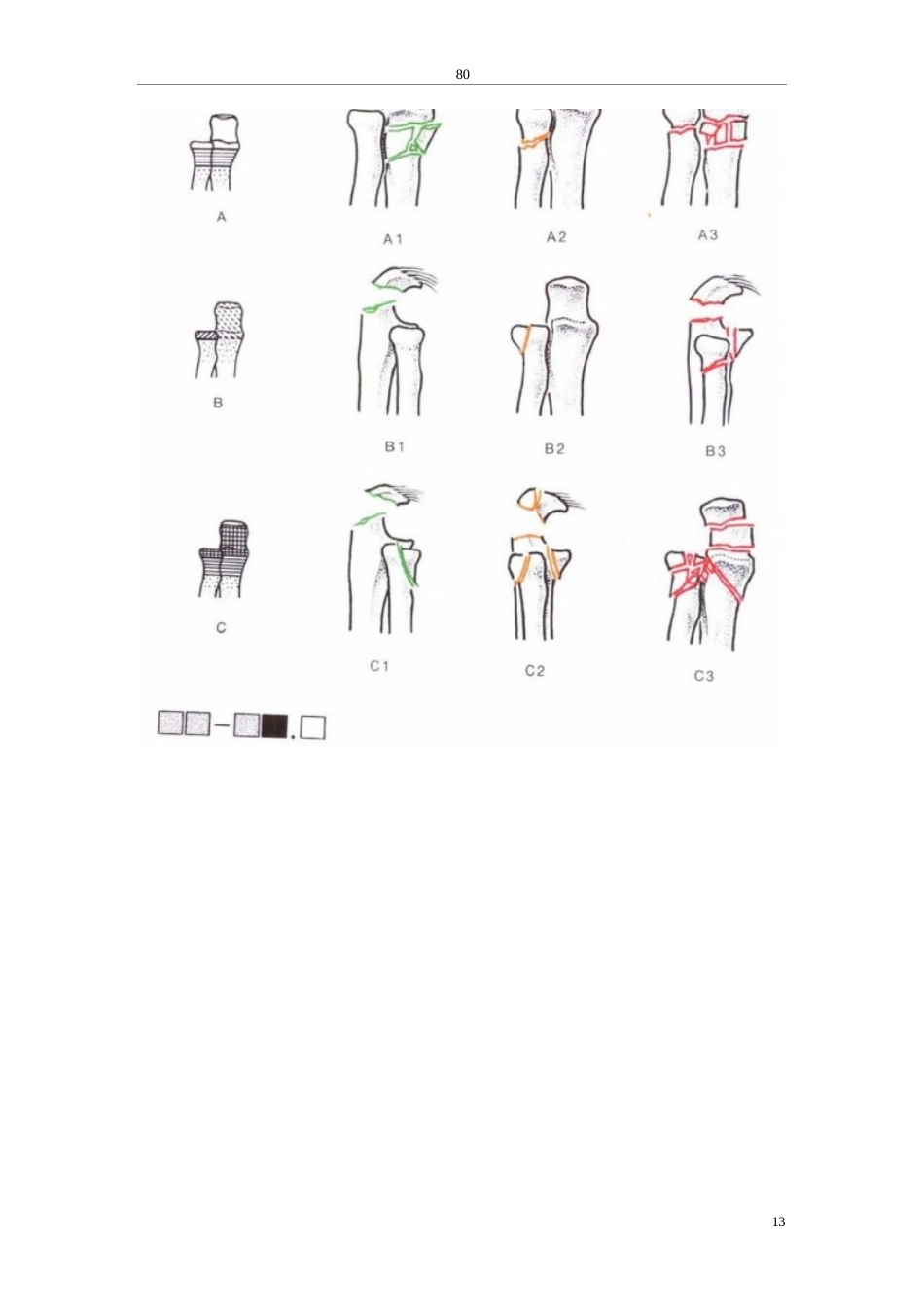 骨科诊断分型_第14页