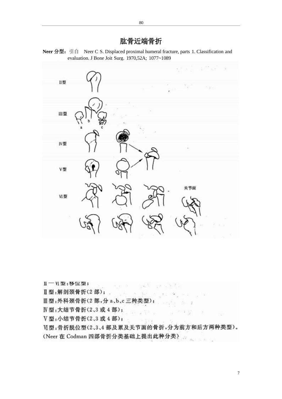 骨科诊断分型_第8页