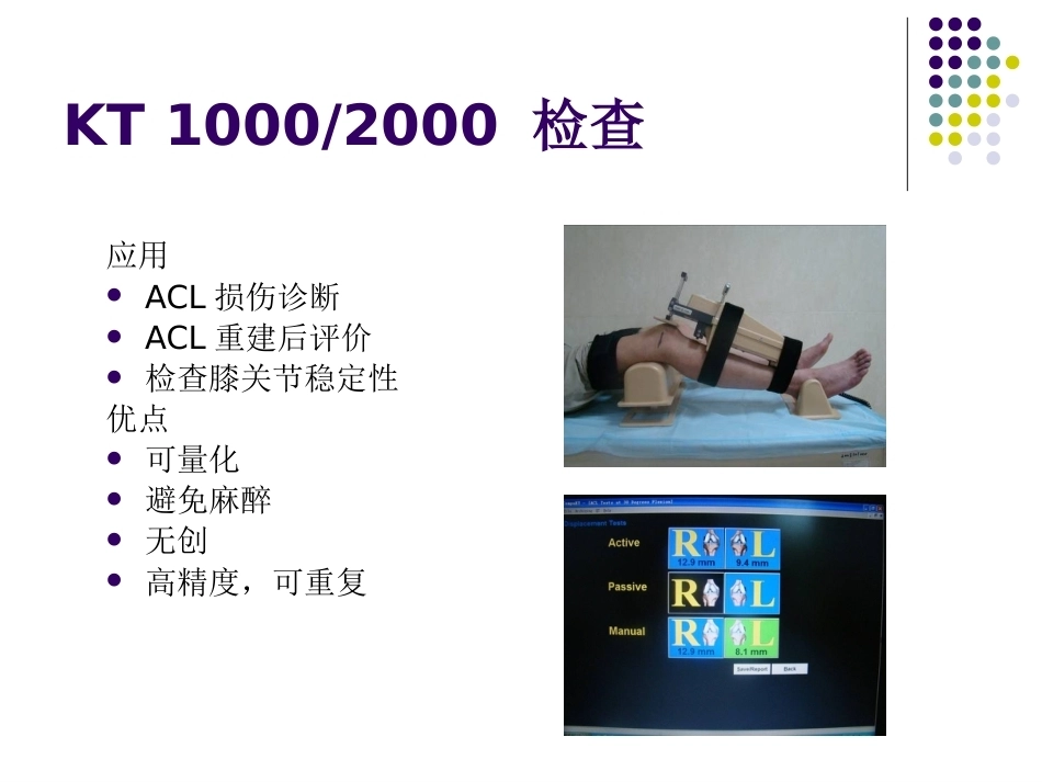 膝关节前交叉韧带损伤诊 断与治疗_第10页