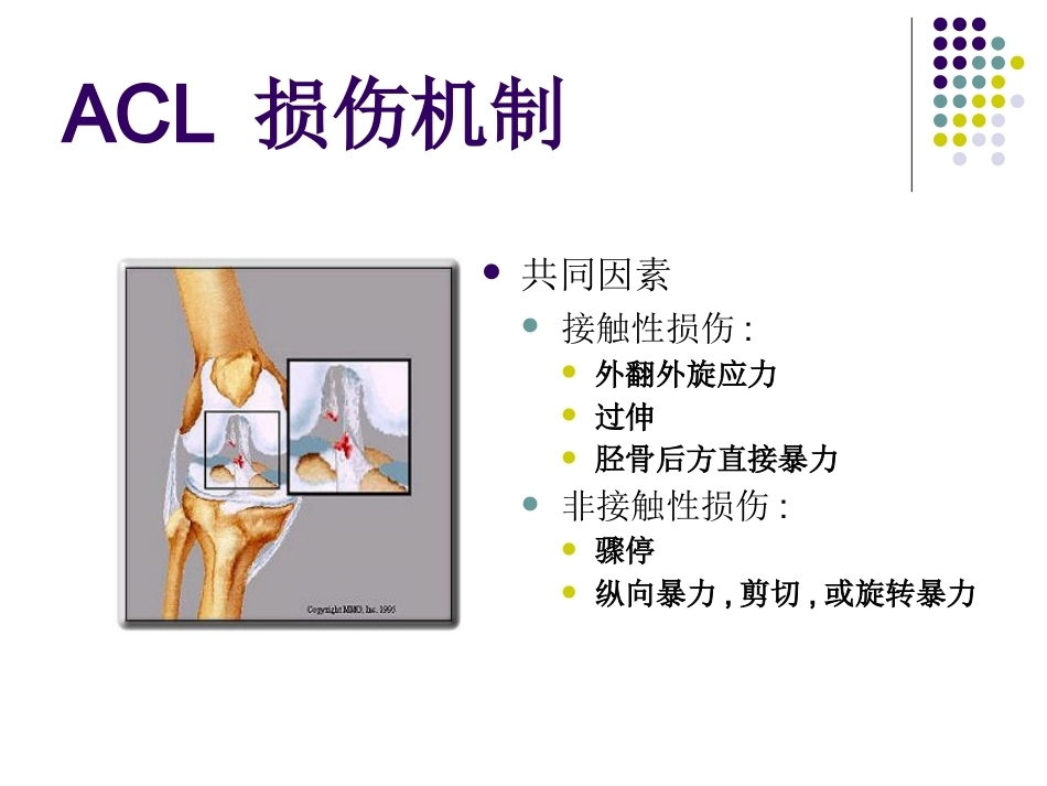 膝关节前交叉韧带损伤诊 断与治疗_第3页