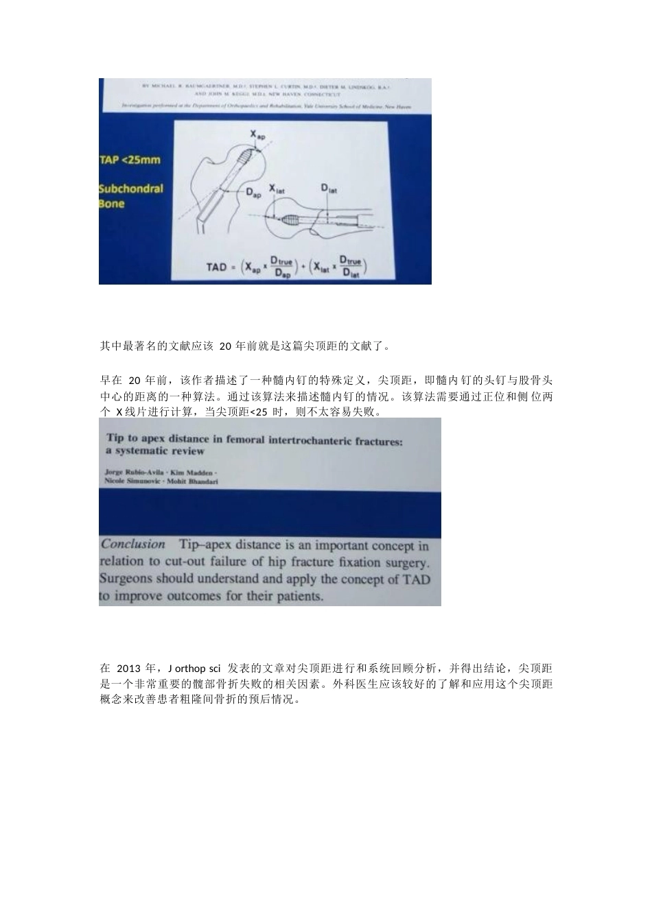 如何提高髓内钉的 内固定强度_第2页