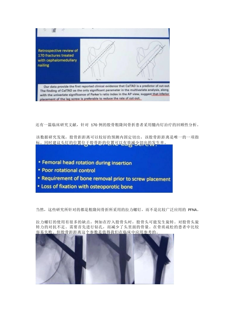 如何提高髓内钉的 内固定强度_第4页