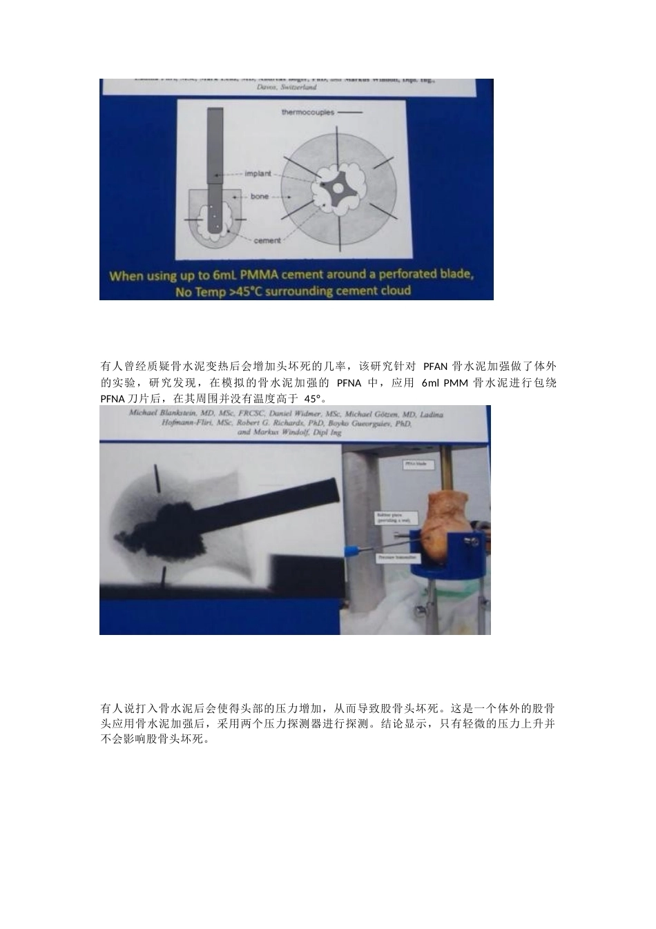 如何提高髓内钉的 内固定强度_第8页